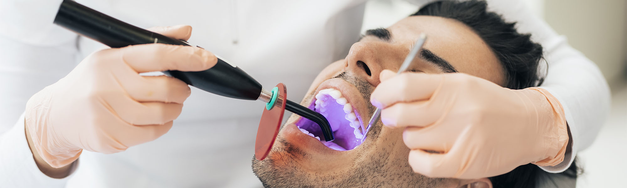 Dental Sealants Whittier CA