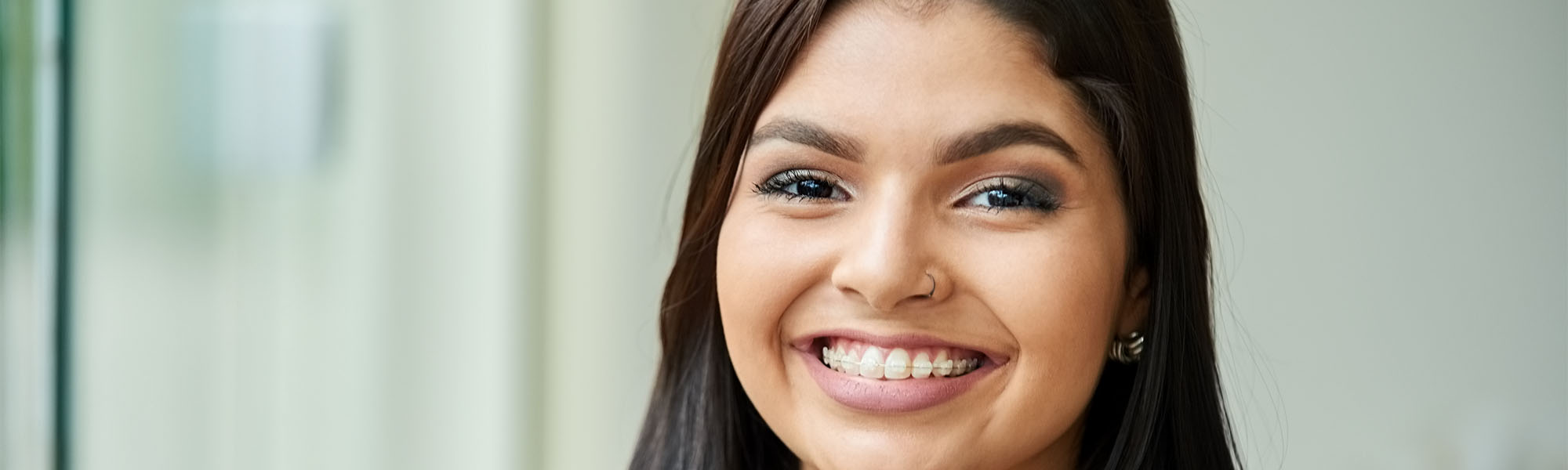 Porcelain Ceramic Braces Whittier CA