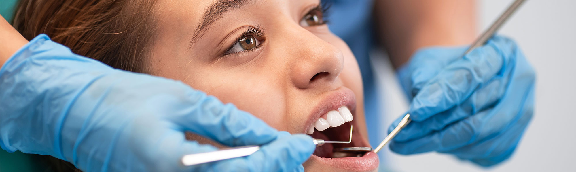 Teeth Cleaning Whittier CA