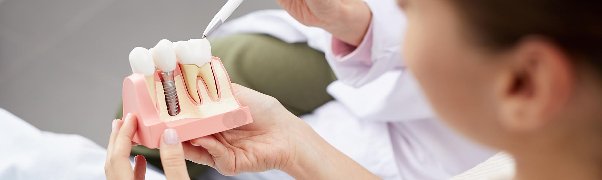 Dental Implants in Whittier