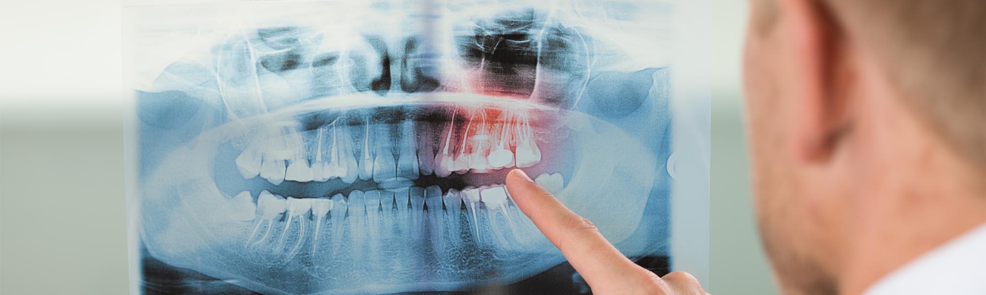 What is 3D Imaging Technology Whittier CA