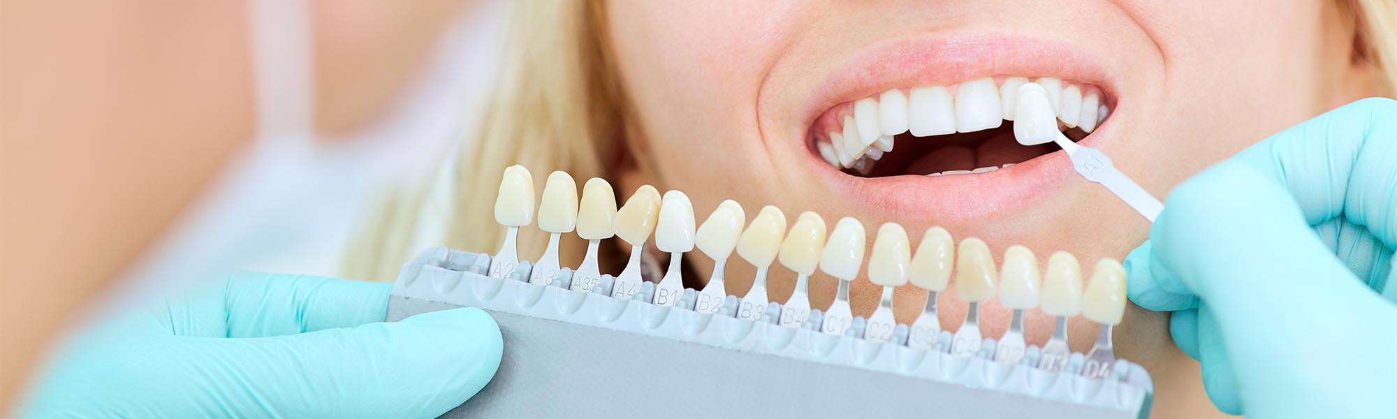 Cosmetic Dentistry Whittier CA