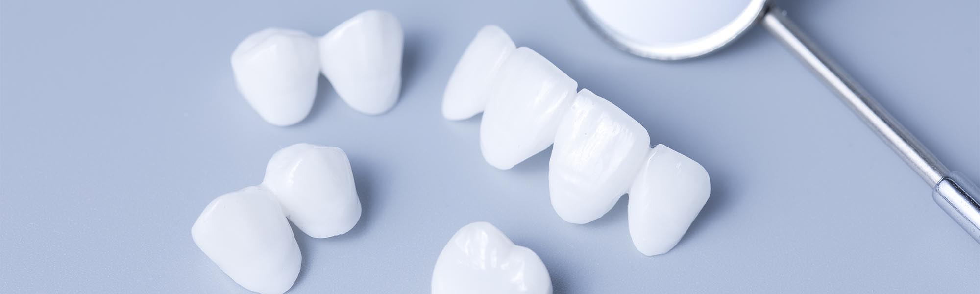 Porcelain Crowns in Whittier CA