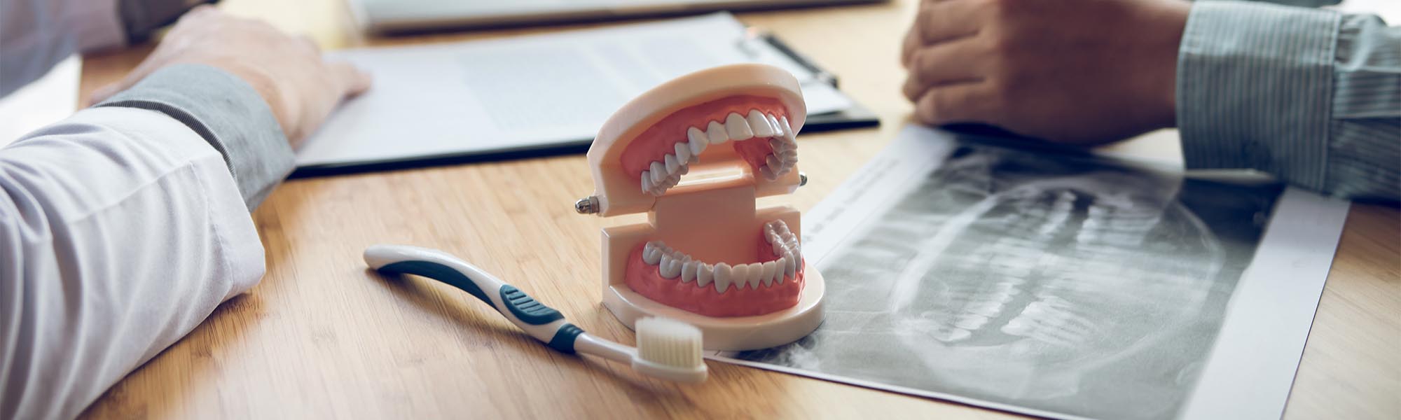 Partial Dentures Whittier CA
