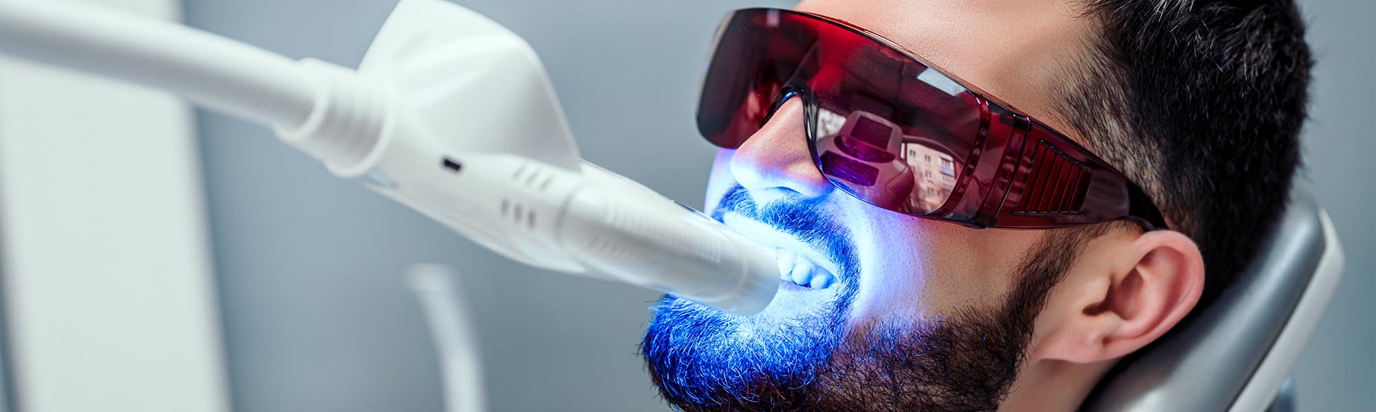 Fluoride Treatment Whittier CA