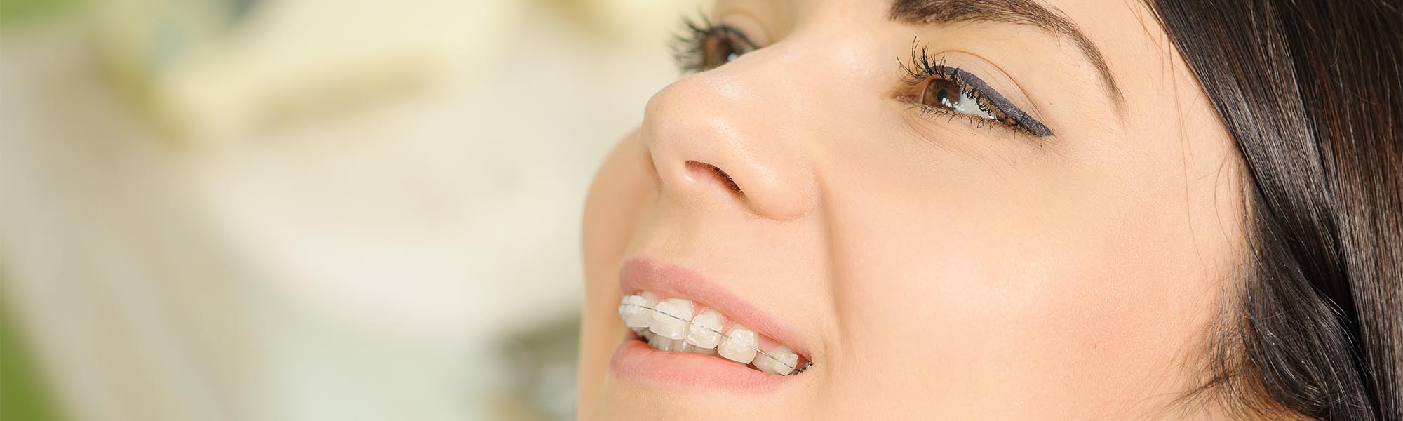 Porcelain Ceramic Braces Whittier CA