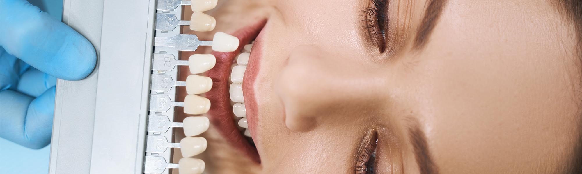 Restorative Dental Treatments Whittier CA