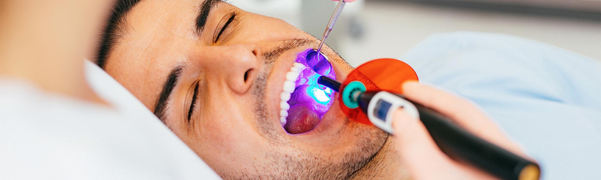 Dental Sealants Whittier CA