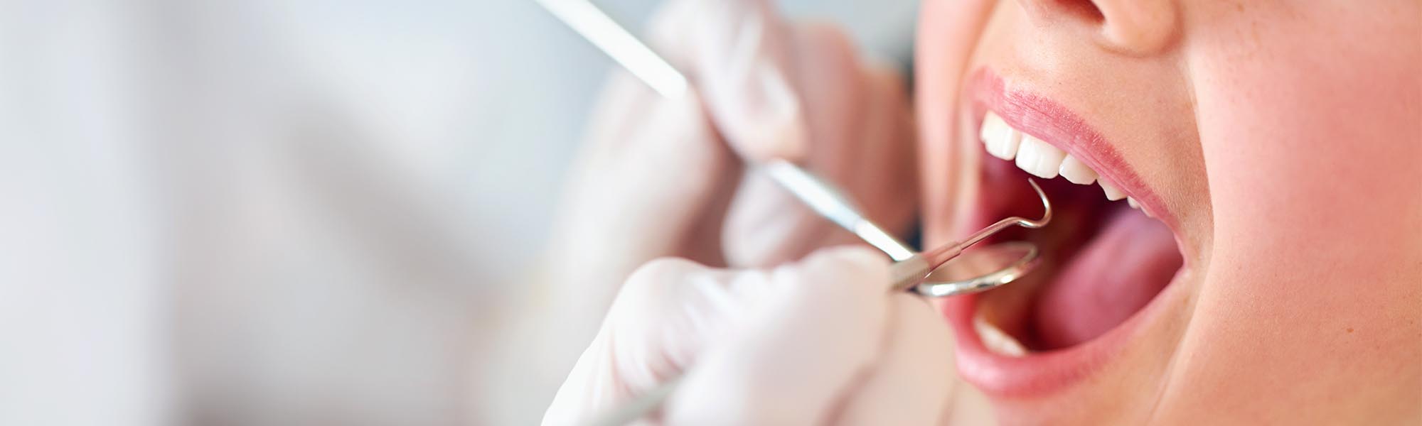 Soft Tissue Grafting Whittier CA