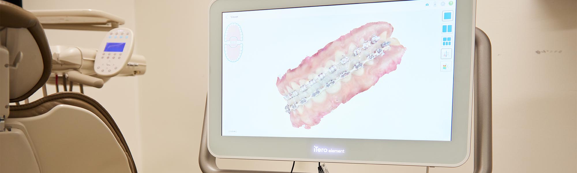 Innovative Dental Technology Whittier CA