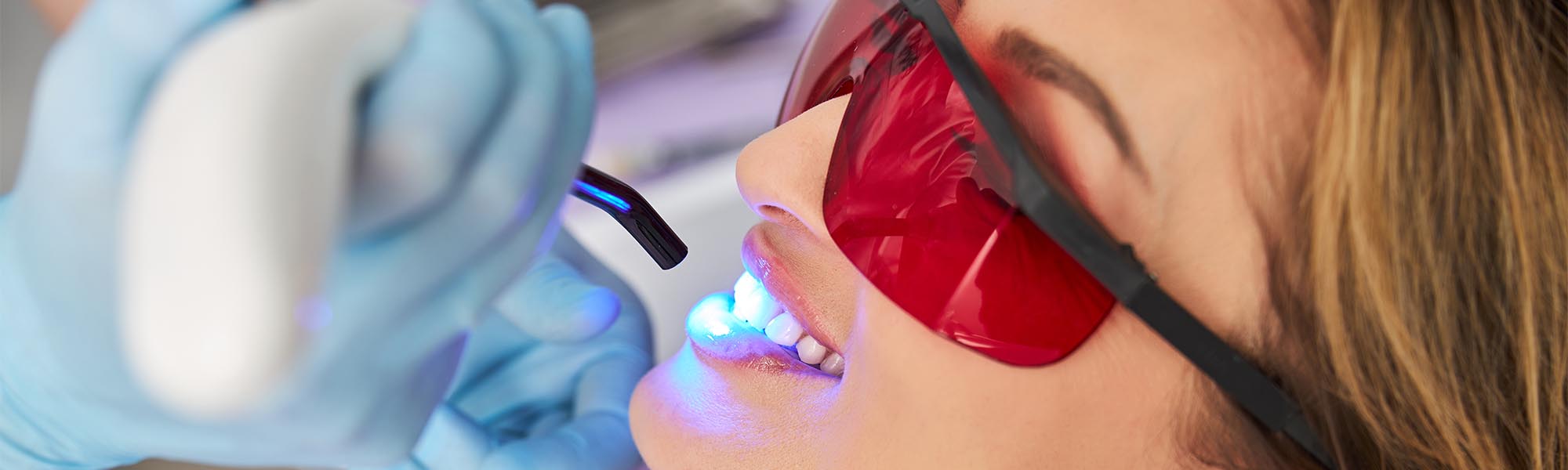 Teeth Whitening Pain Whittier CA