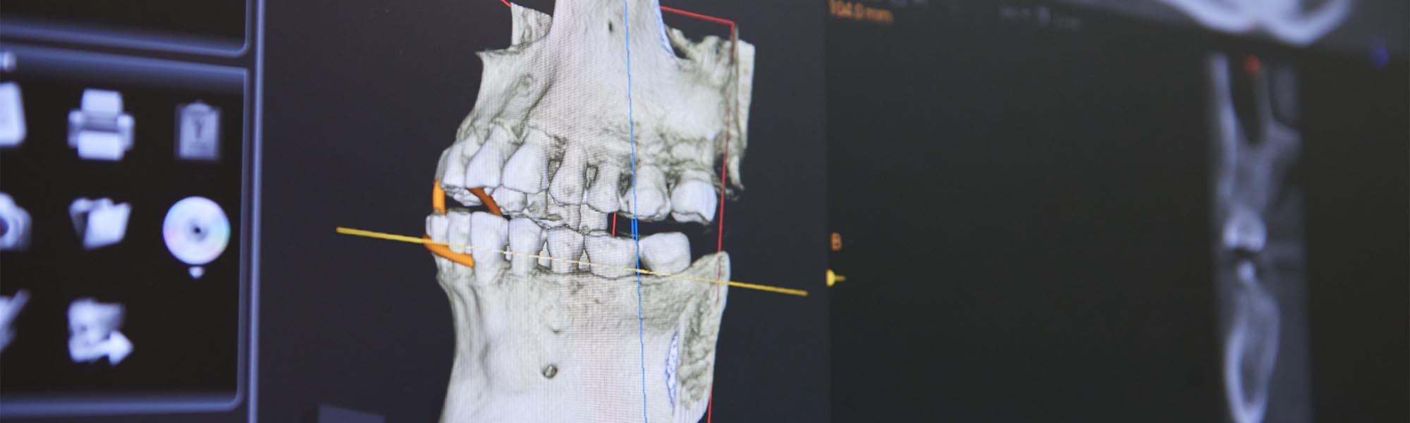 Digital X-rays in Whittier CA
